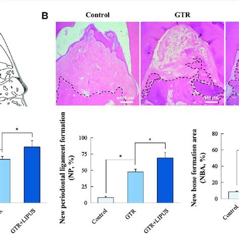 Histological And Histomorphometric Analyses A Schematic Illustration