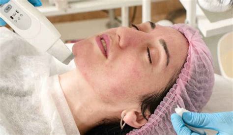 How Does Ipl Help Rosacea Expert Centre