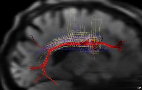 Scans Reveal Intricate Brain Wiring Bbc News