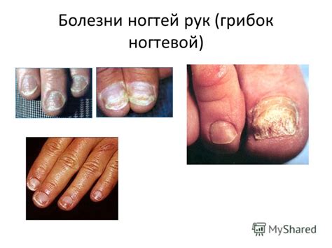 Презентация на тему: "Кожа – наружный покровный орган. Подготовлено ...