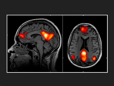 The Fascinating World Of Psychedelics Exploring Their History Effects