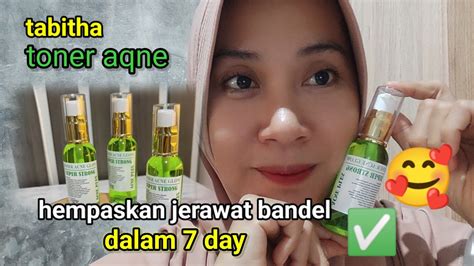 Review Toner Aqne By Tabita Skincare Cara Mengobati Jerawat Parah