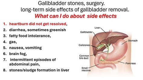 Gallbladder Stones Surgery Side Effects Of Gallbladder Removal What