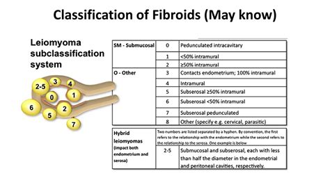 Ppt Uterine Fibroids Powerpoint Presentation Free Download Id691513