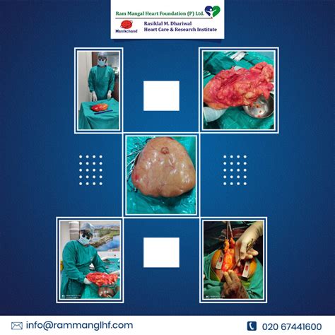 Anterior Mediastinal Mass Surgery By Dr Ranjit Jagtap Ram Mangal