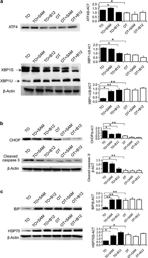 In B Deficient Cells Xbp Atf And Apoptosis Are Activated As