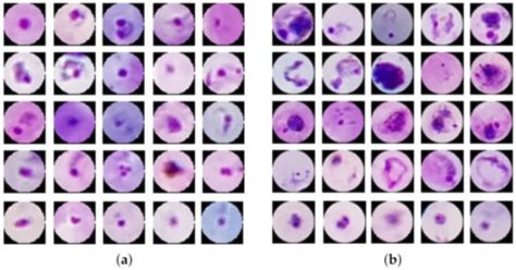 Diagnostics Free Full Text Diagnosing Malaria Patients With