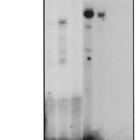 Emsa Of Potential Protein Binding Sites In E1e 32 P Labeled Probes For