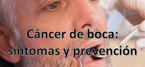 C Ncer De Boca S Ntomas Y Prevenci N