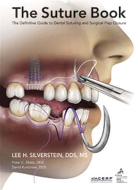 Suturing Dr Silverstein S Rule Of Three S Lee Ann Brady Dmd