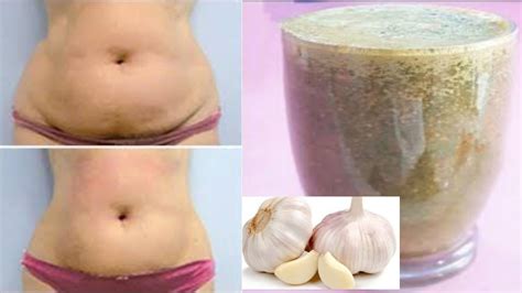 How To Remove Belly Fat With Garlic Weight Loss Remedies Garlic And Honey Recipe For Weight