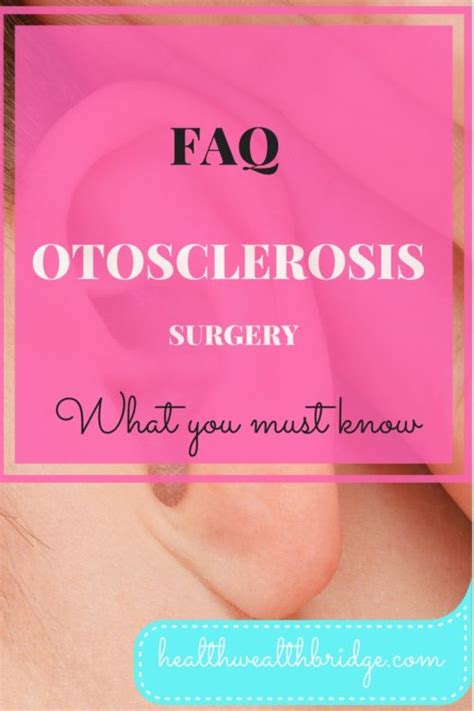 FAQ Otosclerosis Surgery:What you need to know