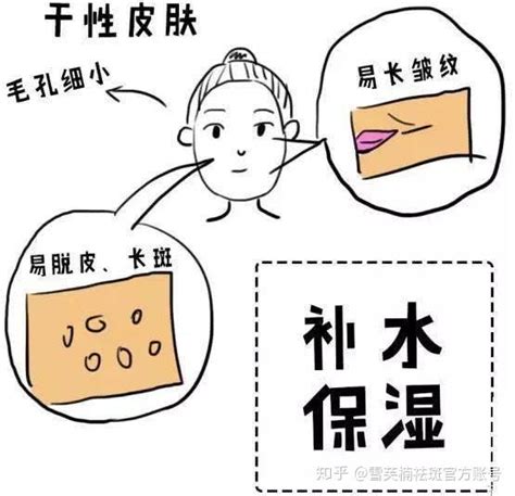 干性皮肤更容易长斑？终于找到答案了！ 知乎