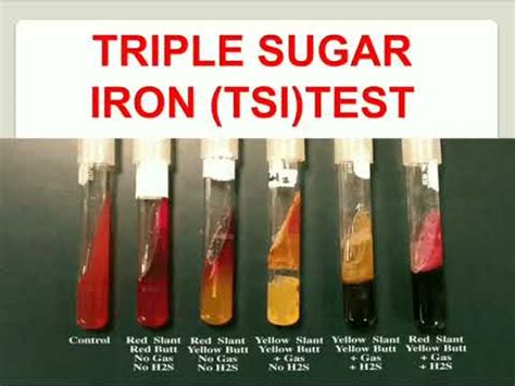 Triple Sugar Iron Tsi Agar Principle Results And Off