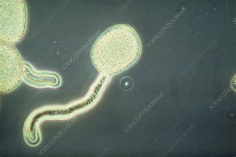 Photomicrogrpah Of A Pollen Tube Stock Image B786 0009 Science