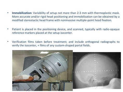 Radiotherapy Plan Evaluation In Brain Tumours