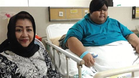 Kisah Bimo Remaja Obesitas Dengan Berat Badan 250 Kg Di RSUP Dr Kariadi