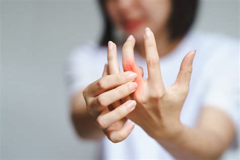 What Are The 4 Stages Of Rheumatoid Arthritis ArthritisCARE