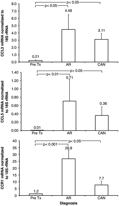 Ccl3 Mip 1a Ccl5 Rantes And Ccr1 Mrna Expression In Renal Allograft