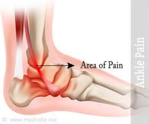 Ankle Pain - Symptom Evaluation