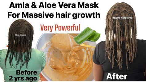 Amla Aloe Vera Hair Mask For Hair Growth How To Use Amla Aloe Vera