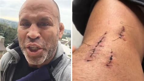 Mmas Wanderlei Silva Stitches Scars Broken Helmet After Brazi