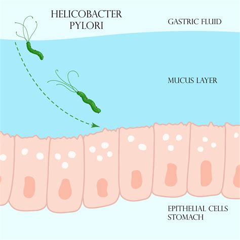 Helicobacter Pylori Na Camada Mucosa Na Ilustra O Do Est Mago