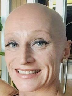 47 Alopecia Ideen In 2024 Glatze Kahle Frauen Rasieren