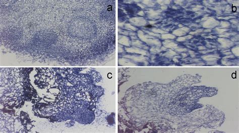 Histology of callus showing (a) scattered spherical globules embedded... | Download Scientific ...