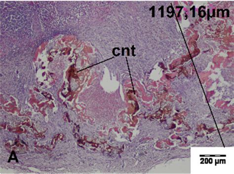 Histopathological Sections Of The Spleen Of The Pig 7 Days After