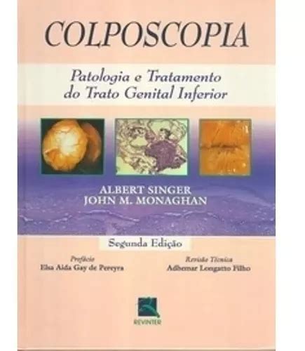 Livro Colposcopia Patologia E Tratamento Do Trato Genital Inferior