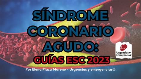 Síndrome coronario agudo Guías ESC 2023 Urgencias y emergencias