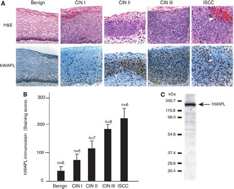 Immunohistochemical Analysis Of Human Wings Apart Like Hwapl Download Scientific Diagram