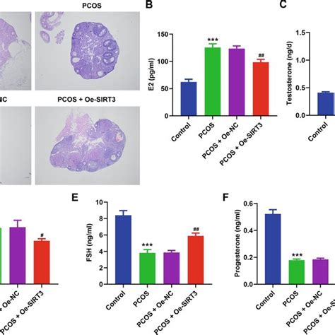 Sirt3 Improves Ovarian Morphology And Serum Sex Hormone Levels In Pcos