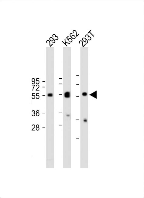 SET07 Antibody Purified Mouse Monoclonal Antibody Mab WB E Buy Now