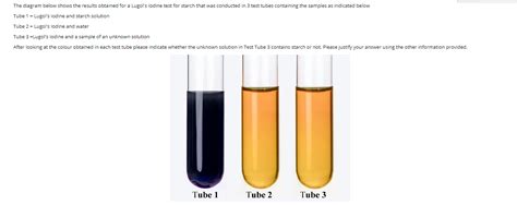 Iodine Test Definition Principle Procedure Result Uses Atelier Yuwa Ciao Jp