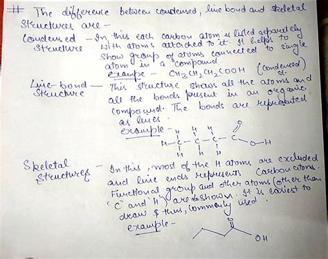 Solved What Is The Difference Between Condensed Line Bond And