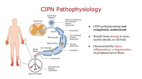 Chemotherapy Induced Peripheral Neuropathy Cipn A Song Of Ice And