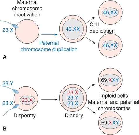 Gestational Trophoblastic Disease Obgyn Key