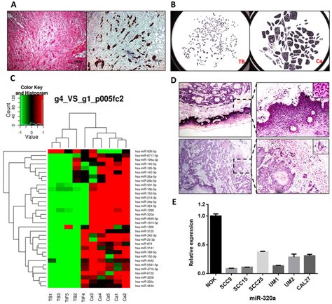 Mir 320a Is Decreased In Tumor Budding Cells Of Tscc A He And