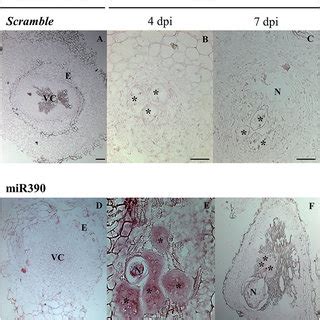 In Situ Detection Of Mature MiR390 Expression In Tomato Galls A C