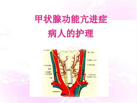 Ppt 甲状腺功能亢进症 病人的护理 Powerpoint Presentation Id4812356