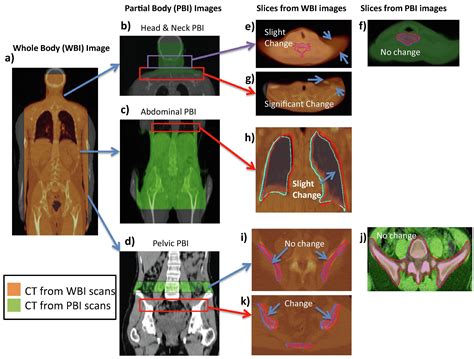 Multi Institutional Evaluation Of Mvct Guided Patient Registration And