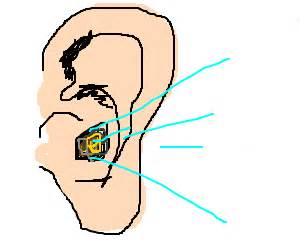 Impacted Cerumen - Drawception