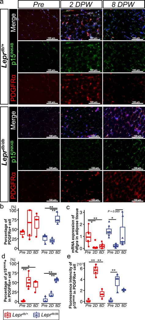 P15INK4B expression in PDGFRα cells in subcutaneous adipose tissue