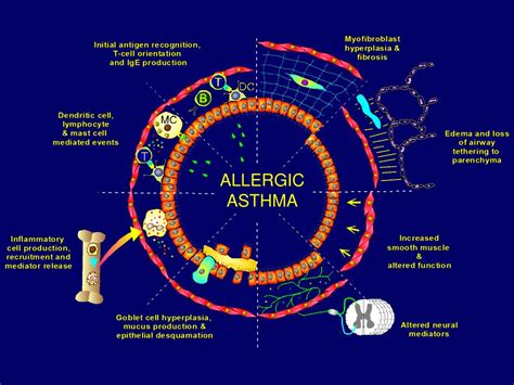 Ppt Allergic Vs Non Allergic Asthma Powerpoint Presentation Free