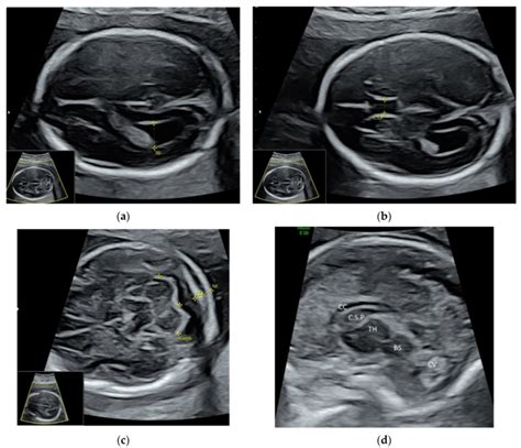 Diagnostics Free Full Text Applications Of Advanced Ultrasound