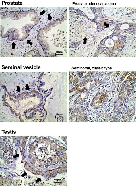 Expression Pattern Of Herv K Env Protein In The Male Reproductive