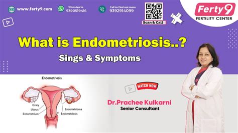 What Is Endometriosis Signs Symptoms Treatment Dr Prachee