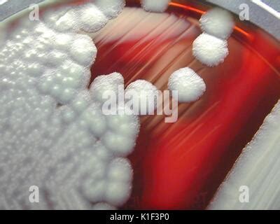 Bacillus cereus showing hemolysis on sheep blood agar. B. cereus is a ...